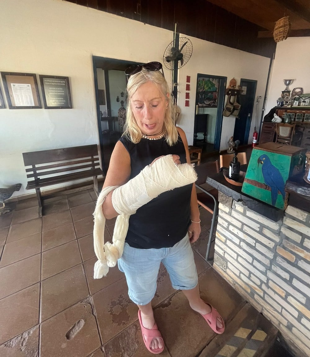 Sally with her hand and arm bandaged after the hospital visit